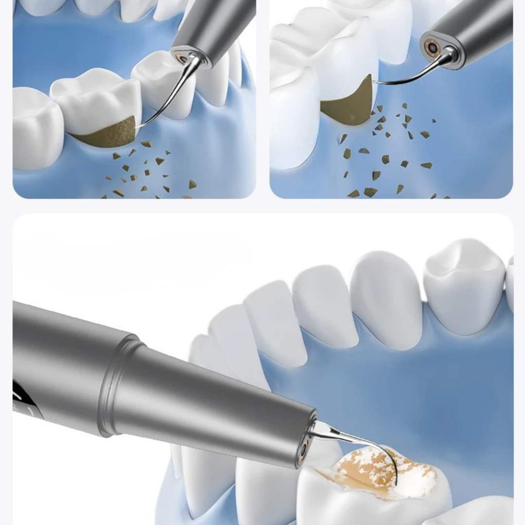 Limpiador dental ultrasónico con cámara HD y luz LED - Madicaza
